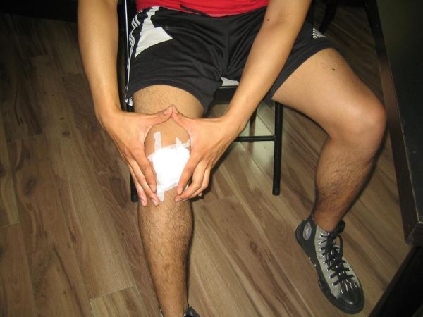 Knee joint issues