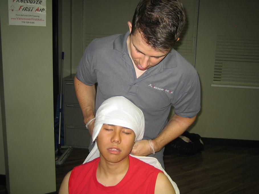 Head Injuries - Applying Gauze, Dressing and Bandage to Wound